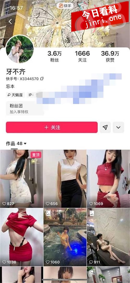 牙不齐 2.jpg